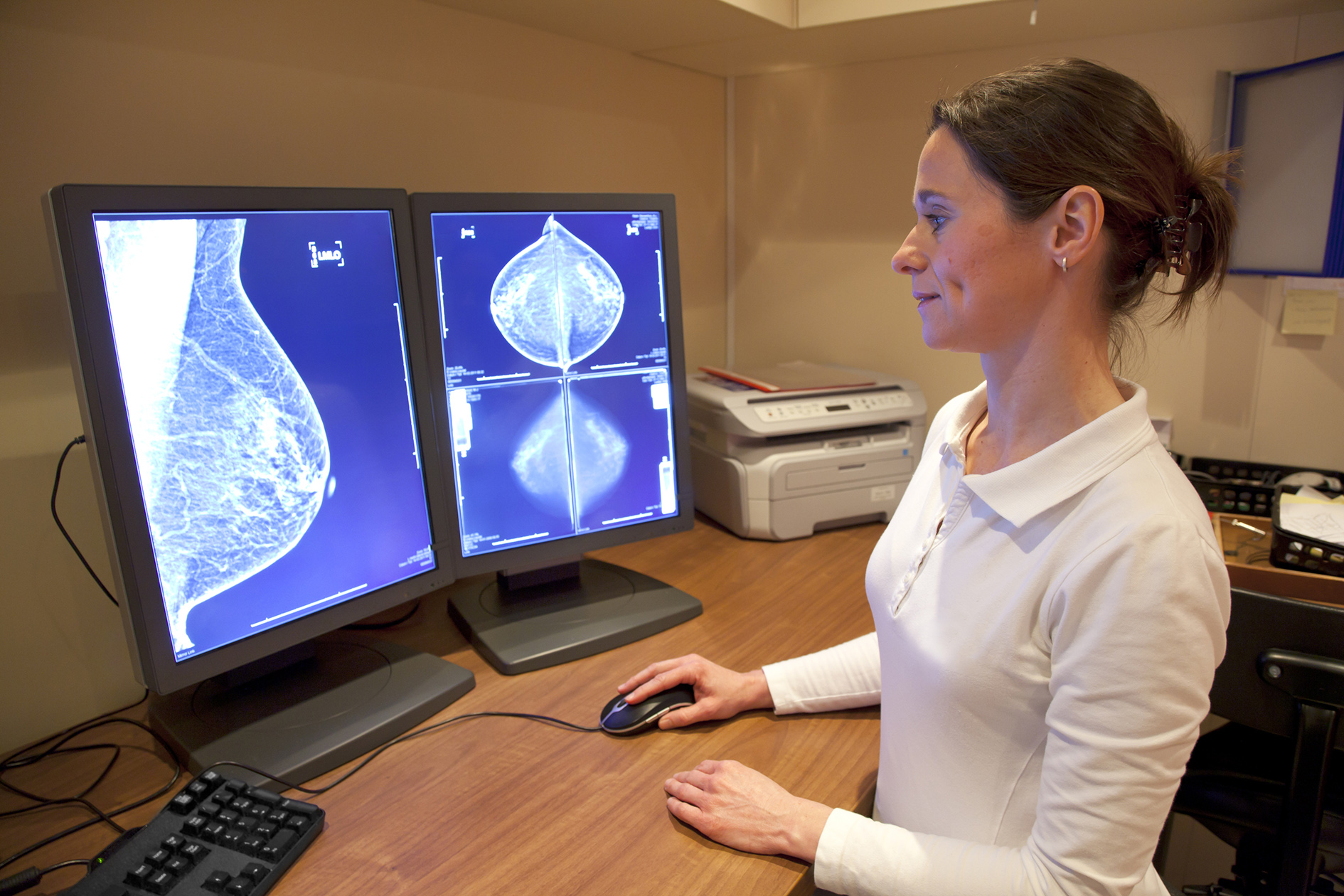 Radiology technician examens mammography test on location